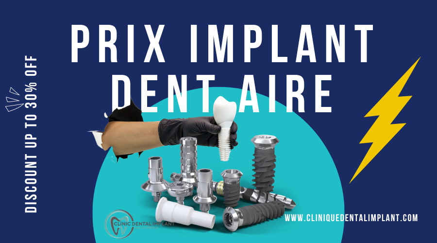 prix implant dentaire