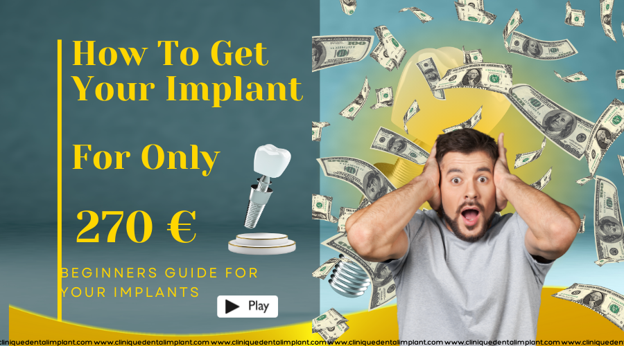 prix implant dentaire